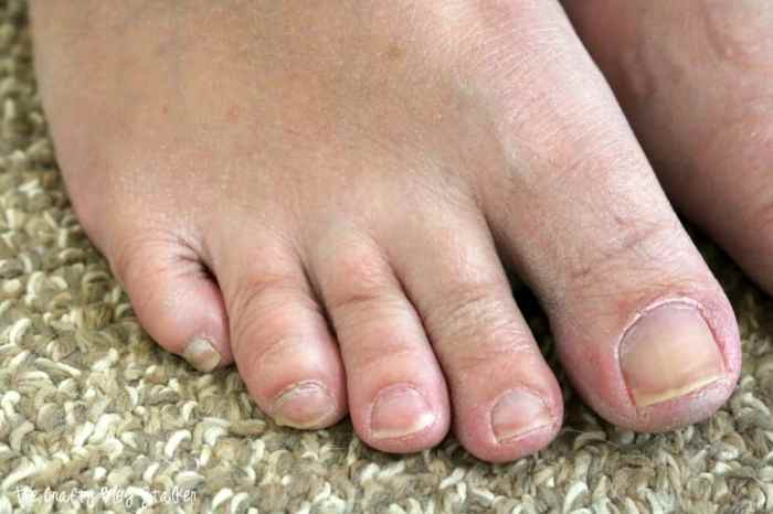 Exfoliation target during a pedicure